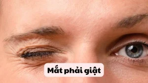 giật mắt phải