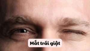 mắt trái giật
